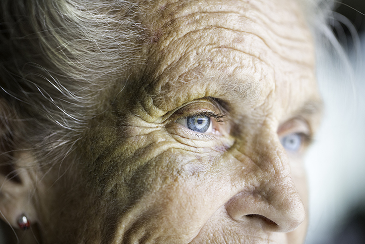 Senior woman with black eye